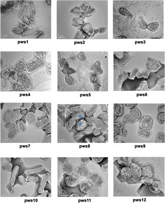 Corrigendum: Isolation and Taxonomic Characterization of Novel Haloarchaeal Isolates From Indian Solar Saltern: A Brief Review on Distribution of Bacteriorhodopsins and V-Type ATPases in Haloarchaea